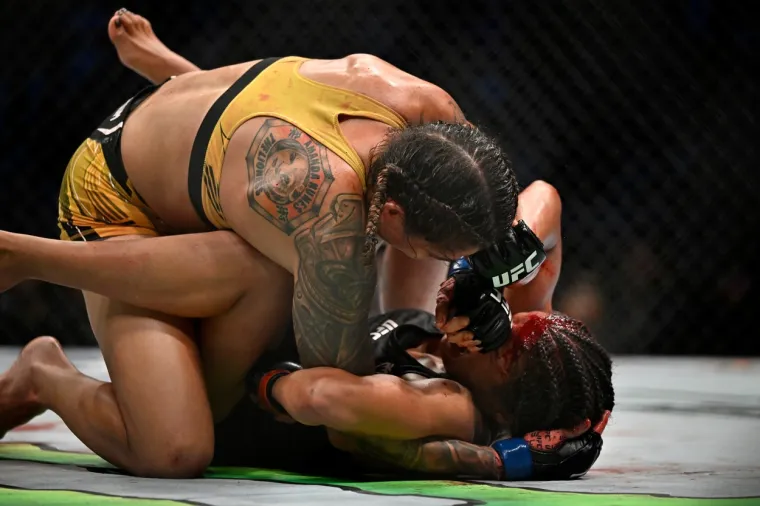 UFC borkinja završila kod plastičnog kirurga nakon užasne ozljede: 'Ostala je bez velikog dijela glave'