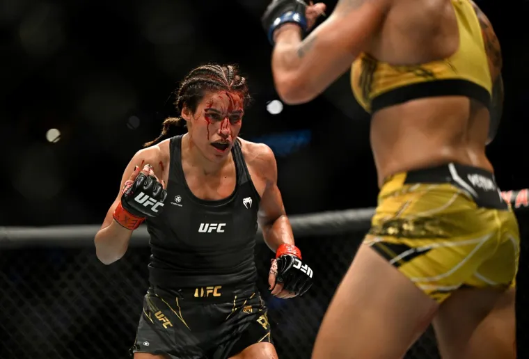 UFC borkinja završila kod plastičnog kirurga nakon užasne ozljede: 'Ostala je bez velikog dijela glave'