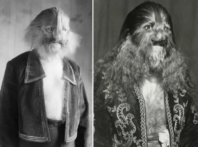Stephan Bibrowski, poznatiji kao Čovjek lavljeg lica, vjerojatno je najpoznatija 'cirkuska nakaza'. Živio je od 1891 do 1932, a imao je poremećaj zbog kojeg mu je po cijelom tijelu rasla gusta dlaka.