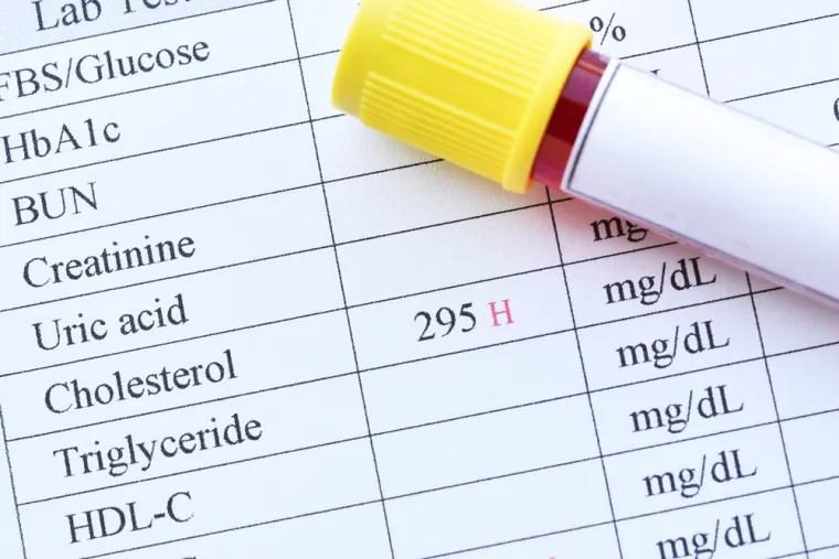Vaše razine kolesterola trebale bi biti: 5 mmol/L ili manje za zdrave odrasle osobe, 4 mmol/L ili manje za osobe s visokim rizikom. Kada se radi o mjerenju lipoproteina niske gustoće - to je ono što se naziva &apos;loš kolesterol&apos; - razine bi trebale biti: 3 mmol/L ili manje za zdrave odrasle osobe, 2 mmol/L ili manje za osobe s visokim rizikom. 