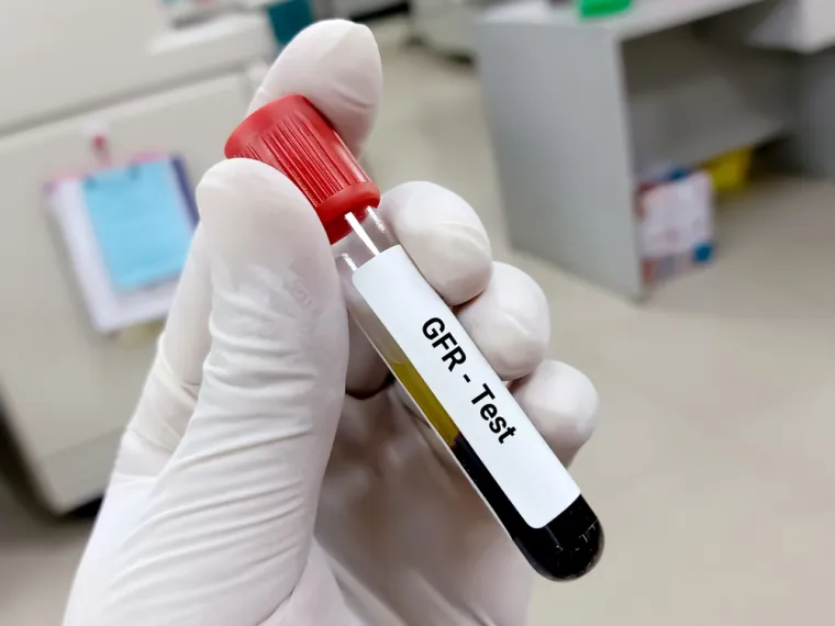 15. eGFR-CKD je računski pojam kojim procjenjujemo koliki je volumen krvi koji se u jedinici vremena očisti od keratinina. Rasponi vrijednosti eGFR-CKD od G1 do G5 ukazuju na stupanj bubrežnog zakazivanja.