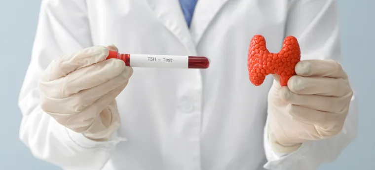 17. TSH je tirotropin proteinski hormon, luči ga hipofiza i važan je za regulaciju hormona štitnjače. U slučaju kada štitnjača ne može raditi dovoljno hormone: trijodtironin (T3) i tiroksin (T4) koncentracija TSH u krvi poraste. TSH tada stimulira štitnjaču pa štitna žlijezda neko vrijeme uspijeva nadoknaditi ukupnu koncentraciju hormona. To stanje nazivamo latentna hipotireoza. Nakon nekog vremena izostaje produkcija hormona štitnjače pa TSH dalje raste – i nastaje klinička hipotireoza (koju će liječnik lako prepoznati po simptomima). Obrnuto, kada dolazi do pojačanog izlučivanja hormona (isto i kod stanja akutne upale štitnjače) vrijednosti TSH su ispod referentnih vrijednosti. Povišene koncentracije hormona štitnjače u tom slučaju djeluju na hipofizu i hipotalamus pa se smanjuje lučenje TSH. Mjerenje TSH u krvi nam daje brzi uvid u funkciju štitnjače, no potrebno je ipak upozoriti na oprez kod interpretacije nalaza TSH jer su moguće iznimke.