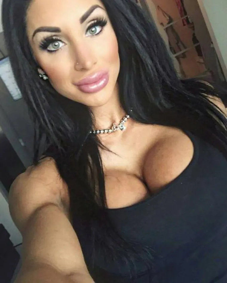 OPSJEDNUTE SU SILIKONIMA: Čini li se i vama da su možda pretjerale s uštrcavanjem plastike u svoje tijelo?