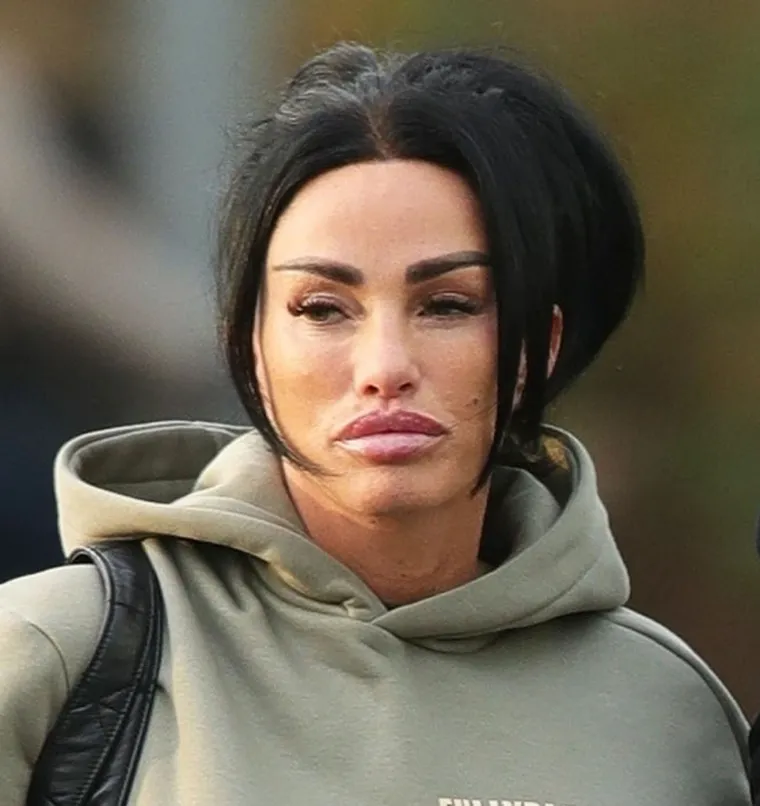 Ona je kraljica plastičnih operacija: Fileri, grudi... Ma tko zna više što je na njoj pravo, Upoznajte Katie Price