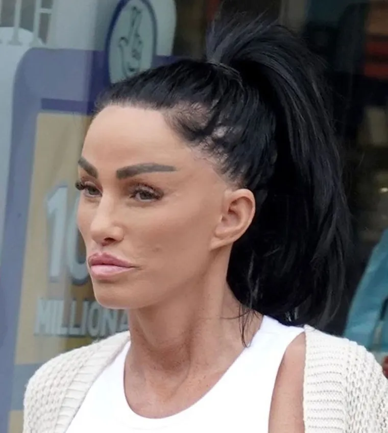 Ona je kraljica plastičnih operacija: Fileri, grudi... Ma tko zna više što je na njoj pravo, Upoznajte Katie Price