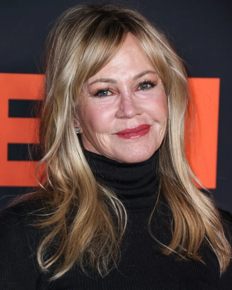 Melanie Griffith zabrinula fanove pojavivši se s neobičnim ožiljcima na licu i rukama: Ovo je izdanje šokiralo svijet