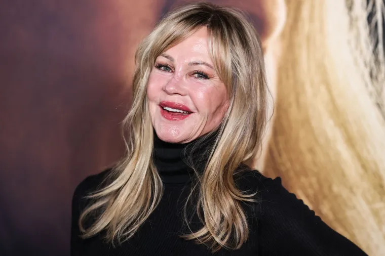 Melanie Griffith zabrinula fanove pojavivši se s neobičnim ožiljcima na licu i rukama: Ovo je izdanje šokiralo svijet