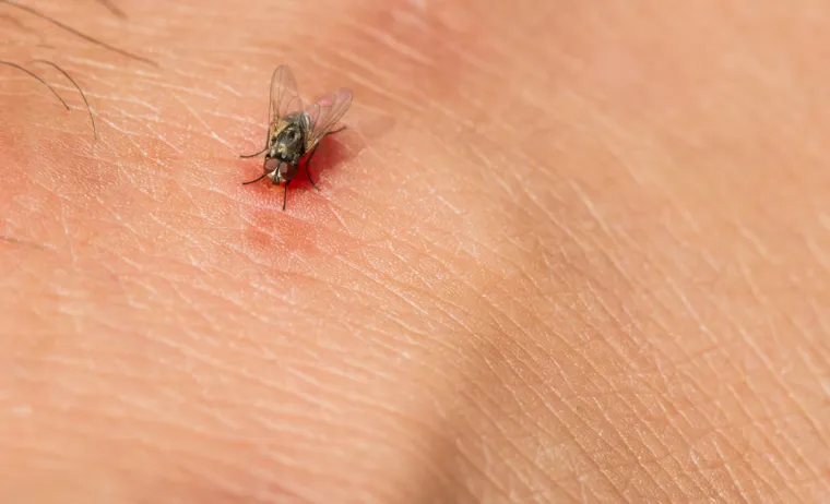 Infestacija bilo koje ličinke muhe unutar tijela poznata je kao mijaza. Uobičajeni simptomi uključuju: kvržicu ispod površine kože, larve koje se kreću ispod kože, svrbež, iritaciju kože, bolove u trbuhu, povraćanje, proljev te larve u izmetu.