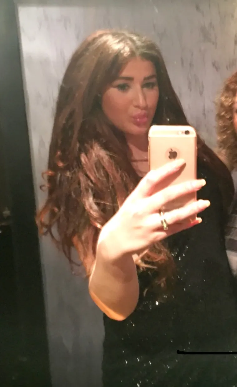 Yasmien Sibel (27) sada izgleda totalno neprepoznatljivo nakon što je prvi put pod nož išla prije devet godina. Foto: Profimedia