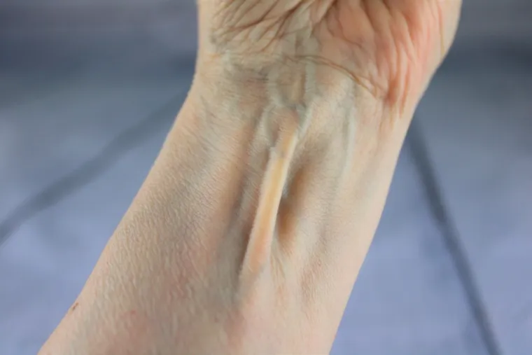 6.Dugačak dlanski mišić:

Palmaris longus proteže se od lakta do zapešća i 11 posto ljudi ga nema.  Nekada je bio ključan za penjanje i vješanje, no njegov nedostatak je toliko beznačajan da većina ljudi niti ne zna da im nedostaje. Ako se pitate , spojite prste  na vrhu i vidite hoće li vam iskočiti tetiva na zapešću.  Ako ga nemate, ne brinite, vaš stisak je jednako snažan, jedino vam je nešto slabiji stisak prstenjaka i malog prsta ( i vjerojatno ne možete pozdraviti kao vulkanci). 
