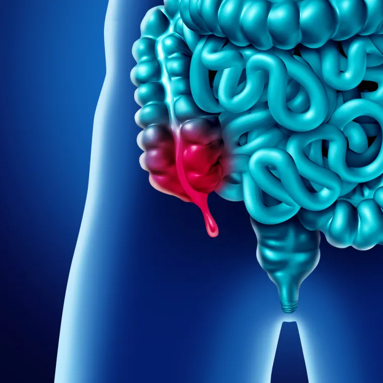 9.Crvuljak: 
Appendix vermiformis, uska mišićna cijev koja je  pričvršćena na debelo crijevo ( u narodu poznat kao slijepo crijevo, no liječnicima slijepo crijevo znači nešto drugo), nekada je omogućavala našim precima da probavljaju celulozu, no vremenom je izgubila tu funkciju. Koju je točno preuzela teško je reći.  Za sada je najbolja pretpostavka da igra ulogu sigurne kuće za dobre bakterije, pa bi se osoba s crvuljkom brže oporavila nakon dijareje. 