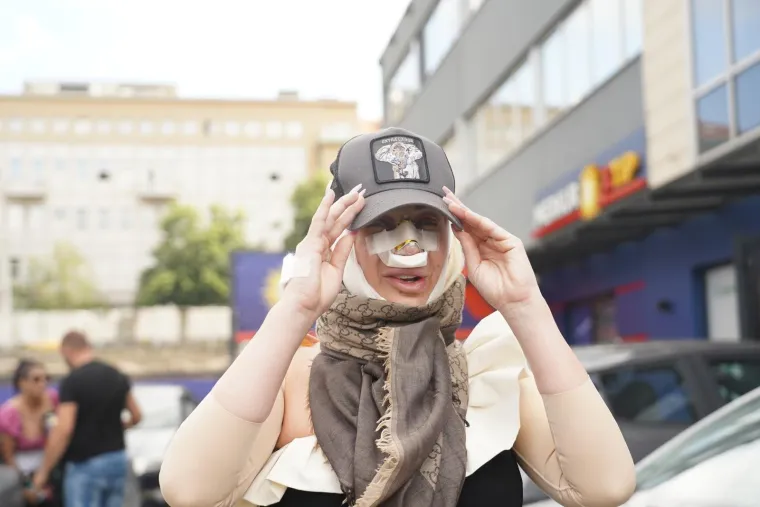 &quot;Odgađala sam mjesec za mjesec i tako smo došli do kraja Zadruge. Da sam te nekirurške intervencije završila tada kada je trebalo, imala bih ih dvije, tri, a mene sljedeći tjedan čeka peta. Nakon toga, početkom srpnja operirat ću i devijaciju. Nagrabusila sam&quot;, rekla je Jakovljević.