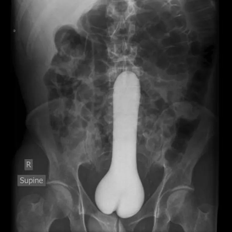 Ogromni dildo