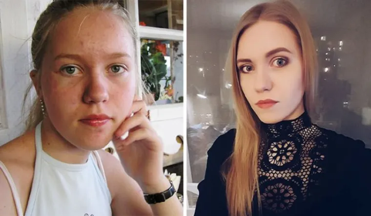 OD RUŽNOG PAČETA DO MODELA: Pokazali svoje transformacije i ostavili sve u šoku
