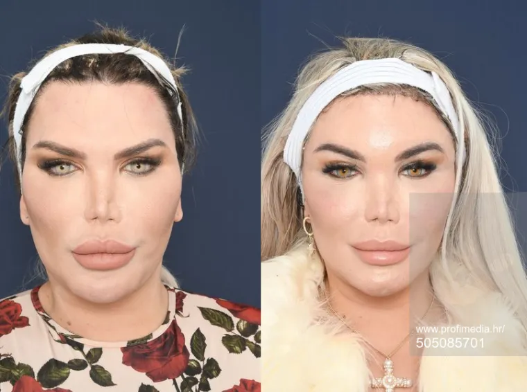 Reality zvijezda Jessica Alves proslavila je prvu godinu svoga procesa prijelaska iz muškarca u ženu, a kako to učiniti bolje, nego izazovnim fotosessionom.