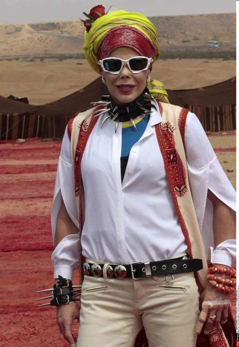 Izgubila dio nosa: Bila je princeza iz snova, a onda dobila infekciju i potpuno se deformirala