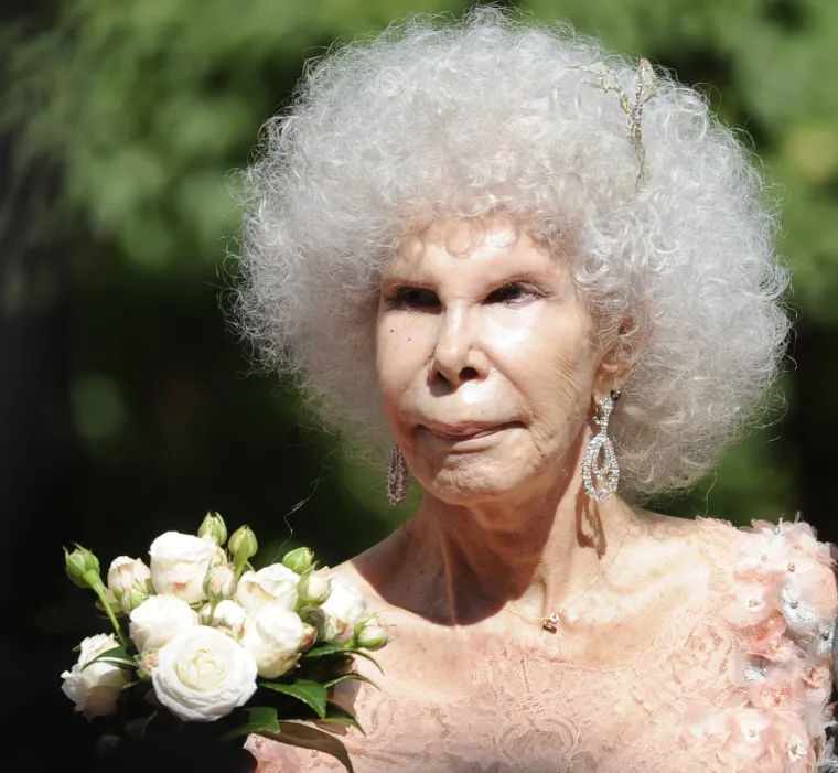 Vojvotkinja od Albe bila je oličenje elegancije, a plastične operacije su joj u potpunosti uništile izgled