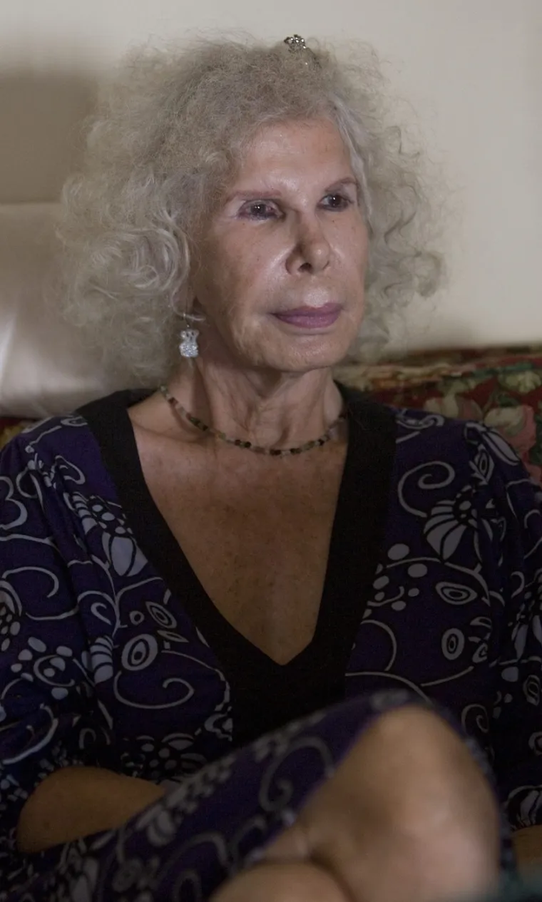 Vojvotkinja od Albe bila je oličenje elegancije, a plastične operacije su joj u potpunosti uni&scaron;tile izgled