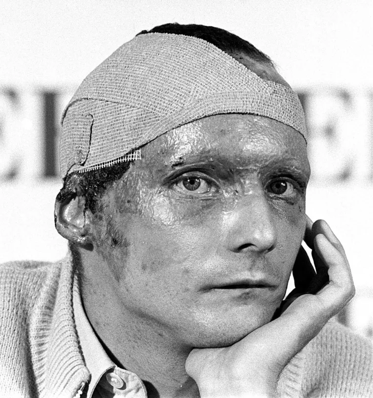 Nevjerojatno, samo šest tjedana (39 dana) nakon nesreće koja ga je zamalo stajala života, Niki Lauda se 12. rujna 1976. pojavio na Velikoj nagradi Italije u Monzi. Njegov izgled bio je šokantan – lice mu je još uvijek bilo teško opečeno i prekriveno krvavim zavojima, a nosio je posebno prilagođenu kacigu kako bi zaštitio rane koje su još uvijek zacjeljivale. Atmosfera u Monzi bila je nabijena emocijama; navijači, kolege vozači i cijela motorsport zajednica bili su zadivljeni njegovom hrabrošću.