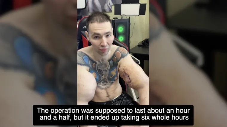 Htio je imati ruke kao bazuke, ali se zaigrao s vazelinom i stavio liječnike na goleme muke