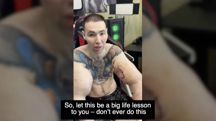 Htio je imati ruke kao bazuke, ali se zaigrao s vazelinom i stavio liječnike na goleme muke