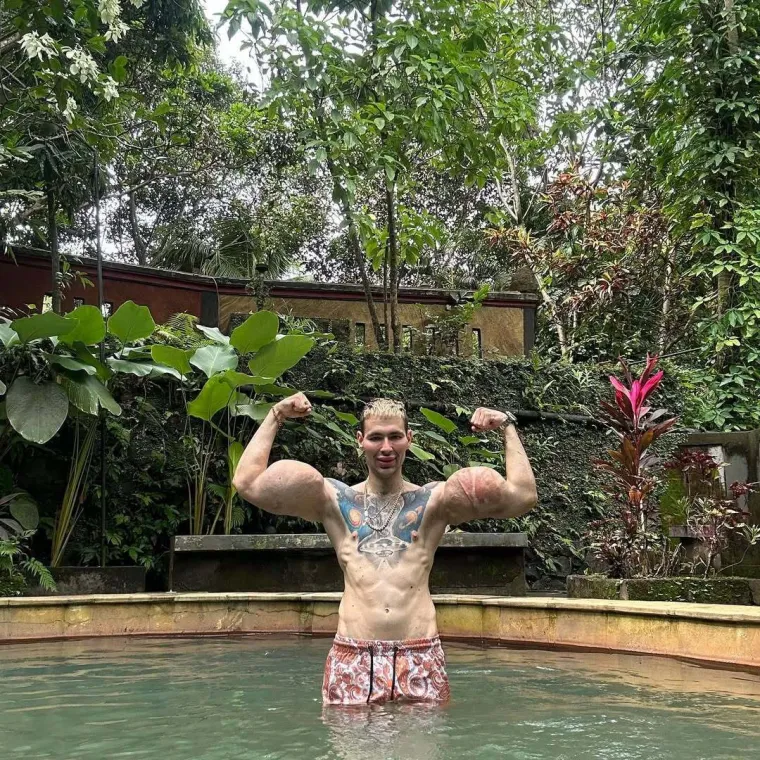 Htio je imati ruke kao bazuke, ali se zaigrao s vazelinom i stavio liječnike na goleme muke