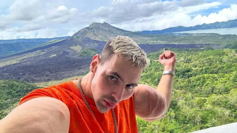 Htio je imati ruke kao bazuke, ali se zaigrao s vazelinom i stavio liječnike na goleme muke