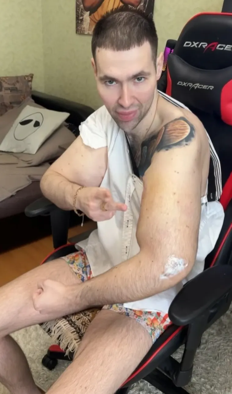 Htio je imati ruke kao bazuke, ali se zaigrao s vazelinom i stavio liječnike na goleme muke