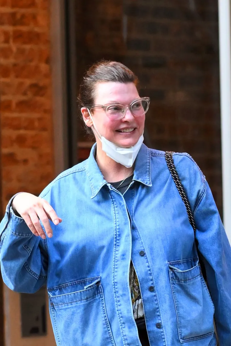 Kad estetske operacije pođu po zlu: Donosimo &scaron;okantne transformacije poznatih zvijezda