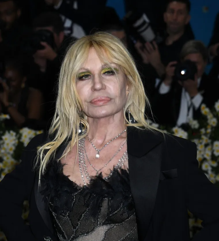 Kad estetske operacije pođu po zlu: Donosimo &scaron;okantne transformacije poznatih zvijezda