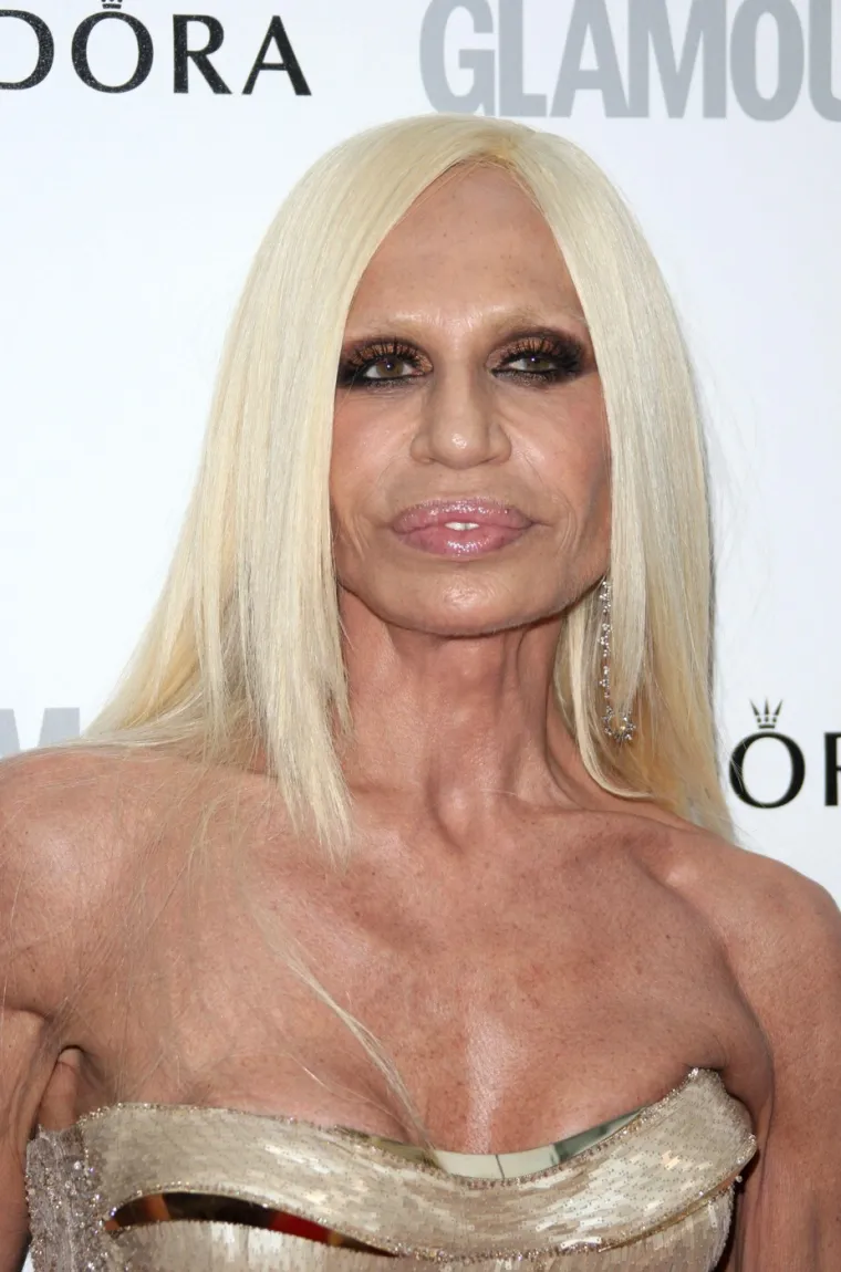 Kad estetske operacije pođu po zlu: Donosimo &scaron;okantne transformacije poznatih zvijezda