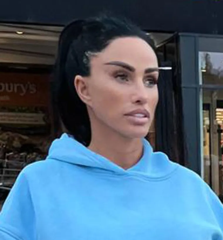 Kad estetske operacije pođu po zlu: Donosimo &scaron;okantne transformacije poznatih zvijezda