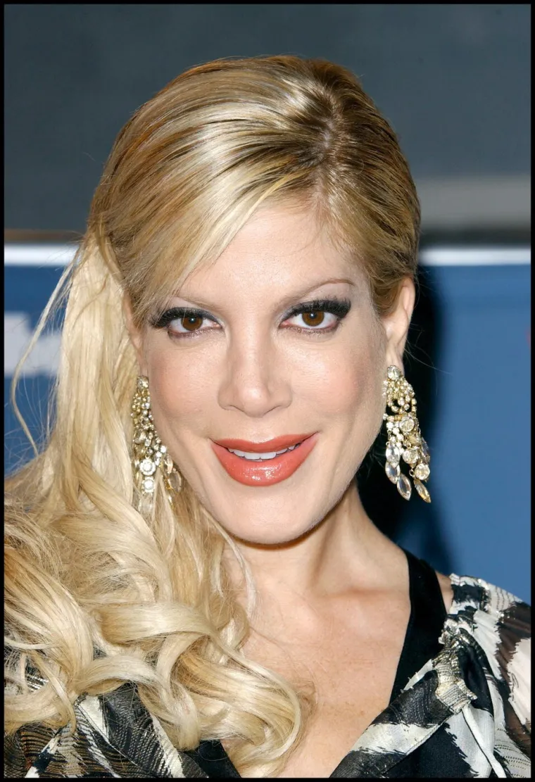 Kad estetske operacije pođu po zlu: Donosimo &scaron;okantne transformacije poznatih zvijezda