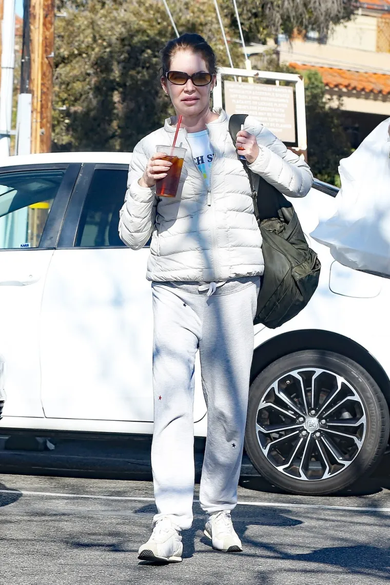 Život je nije mazio, a estetske operacije su je uni&scaron;tile: Ovako danas izgleda jedna od omiljenih ljepotica 90-ih