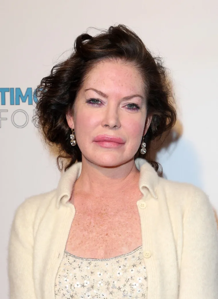 Život je nije mazio, a estetske operacije su je uni&scaron;tile: Ovako danas izgleda jedna od omiljenih ljepotica 90-ih