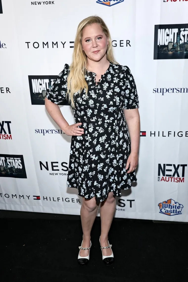 Čak 30 kilograma manje, ali pod koju cijenu? Glumica Amy Schumer pristala na sve