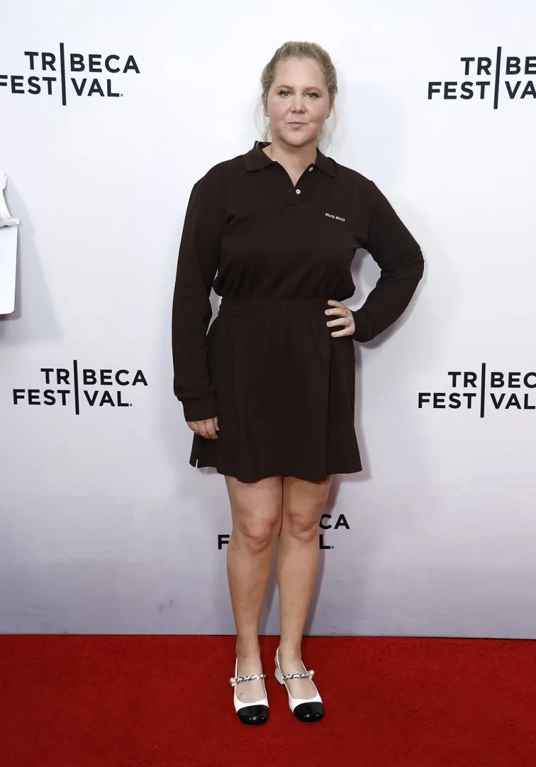 Čak 30 kilograma manje, ali pod koju cijenu? Glumica Amy Schumer pristala na sve