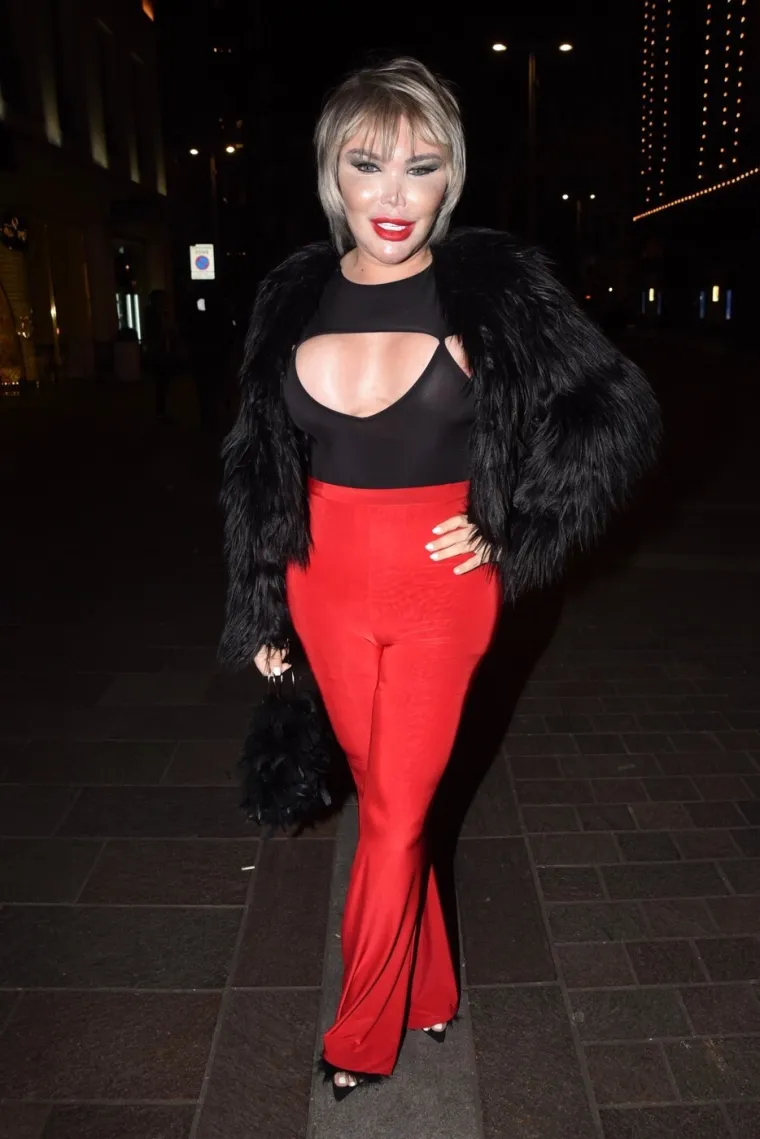 Nekada Ken, a danas Barbie: Jessica Alves na svoju tranziciju je potro&scaron;ila pravo bogatstvo