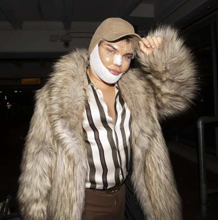 Nekada Ken, a danas Barbie: Jessica Alves na svoju tranziciju je potro&scaron;ila pravo bogatstvo