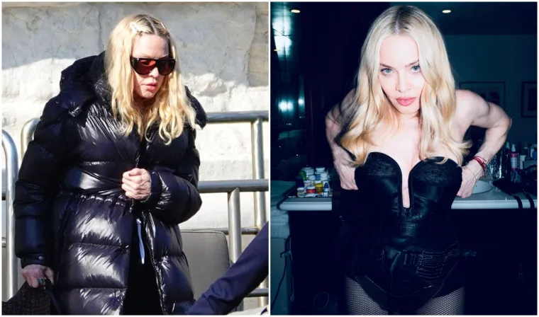 Bila je poznata po jedinstvenom izgledu, a sada je neprepoznatljiva: Madonna ne želi ostariti