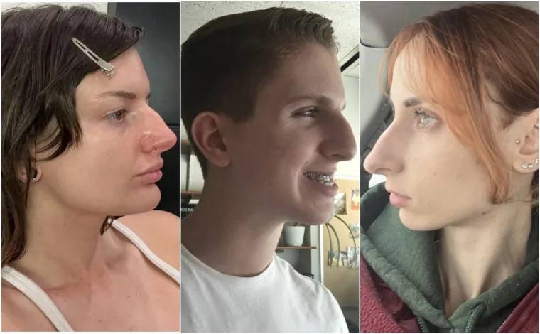 Zatražili su pomoć kirurga i iz bolnica izašli oduševljeni, ruke tih liječnika učinile su čuda!