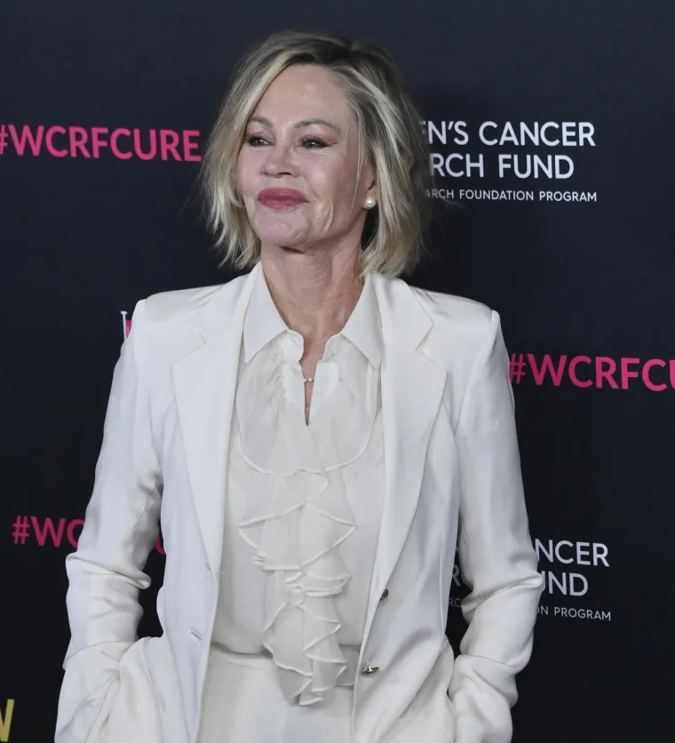 Prepoznajete li je? Udavala se pet puta, borila s porocima, a lice potpuno promijenila operacijama