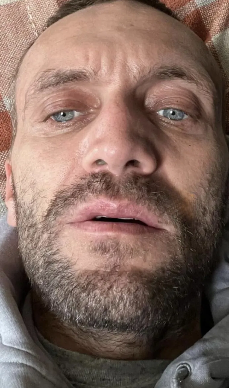 Ušmrkao je u sebe preko dva i pol milijuna eura, stravično je što mu je preostalo od nosa