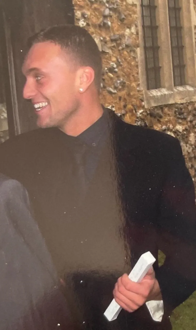 Ušmrkao je u sebe preko dva i pol milijuna eura, stravično je što mu je preostalo od nosa