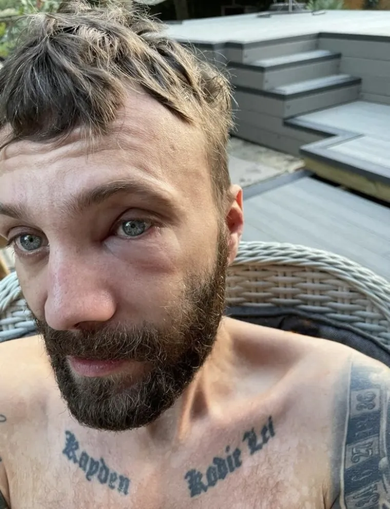 U&scaron;mrkao je u sebe preko dva i pol milijuna eura, stravično je &scaron;to mu je preostalo od nosa