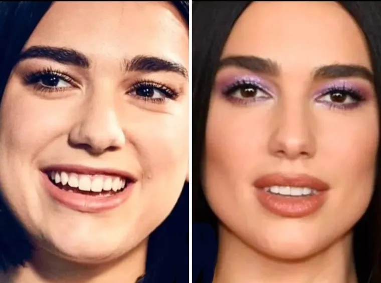 Pogledajte kako je Dua Lipa izgledala prije nego što je postala svjetska zvijezda