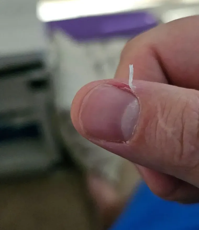 Kome lažemo da treba čuvati živce? Sve ove situacije uvijek će vam u sekundi dići tlak i pokvariti dan