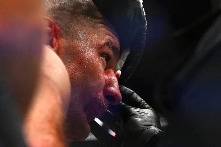 Skandal u svijetu slobodne borbe: Hoće li se biv&scaron;i UFC prvak moći oporaviti nakon ovog incidenta?