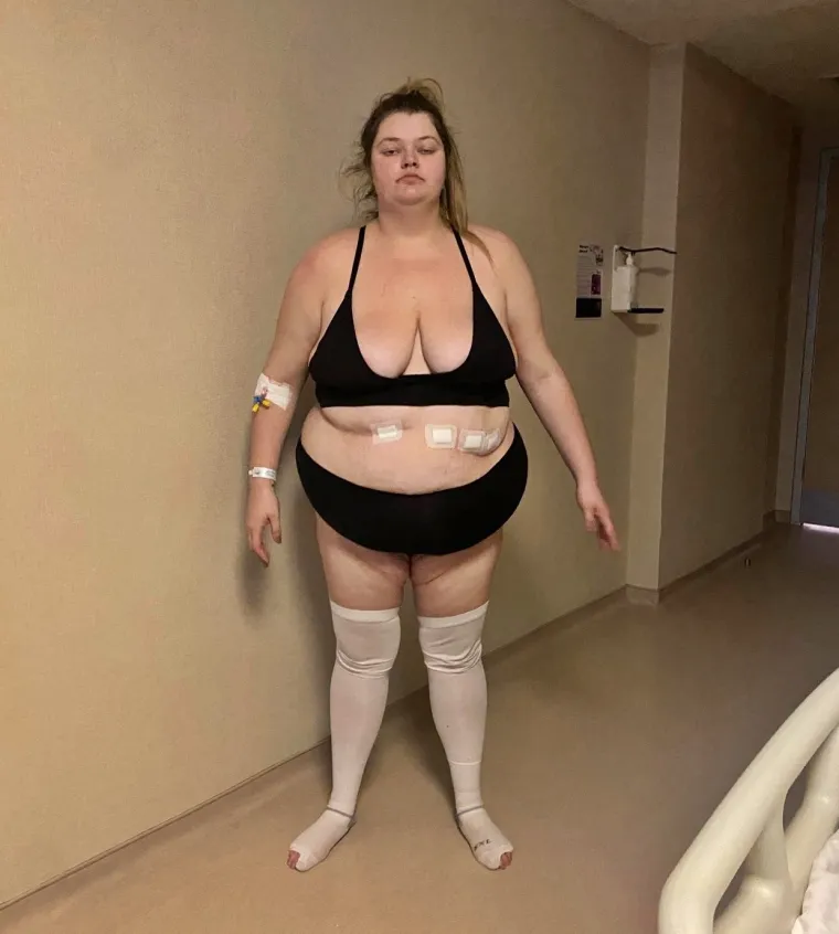 Odustali od kupnje kuće pa potro&scaron;ili 20 tisuća funti na mr&scaron;avljenje: Zajedno skinuli 150 kilograma