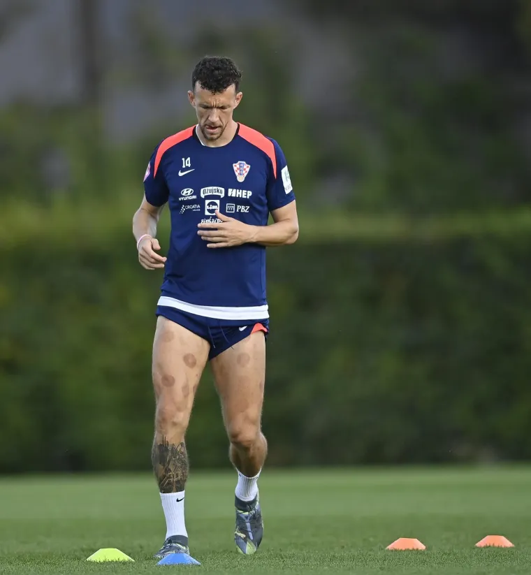 Peri&scaron;ić pokazao čudne fleke na nogama, a jedan detalj mogao bi nas zabrinuti: Drži li se to Vatreni za zadnju ložu?